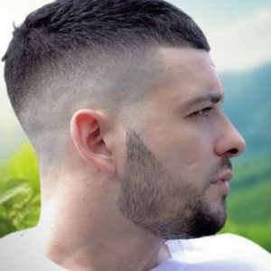 hair loss